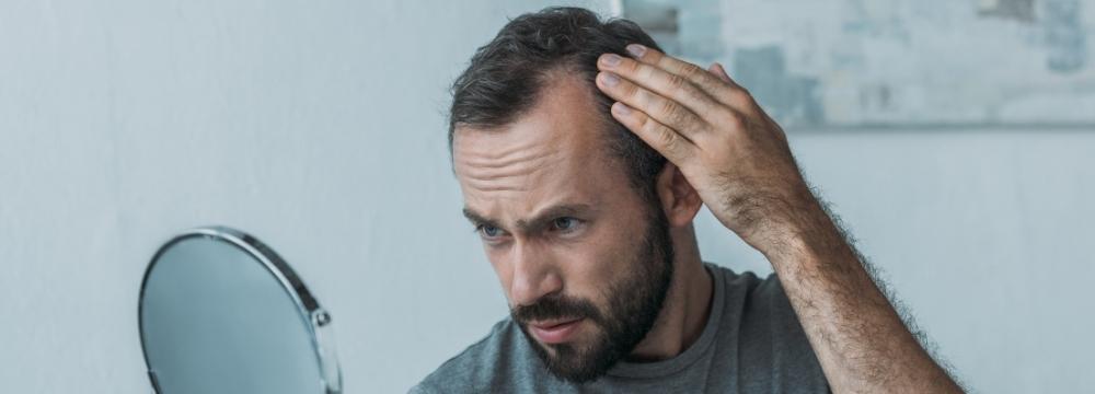 Man with low testosterone checks balding head with handheld mirror